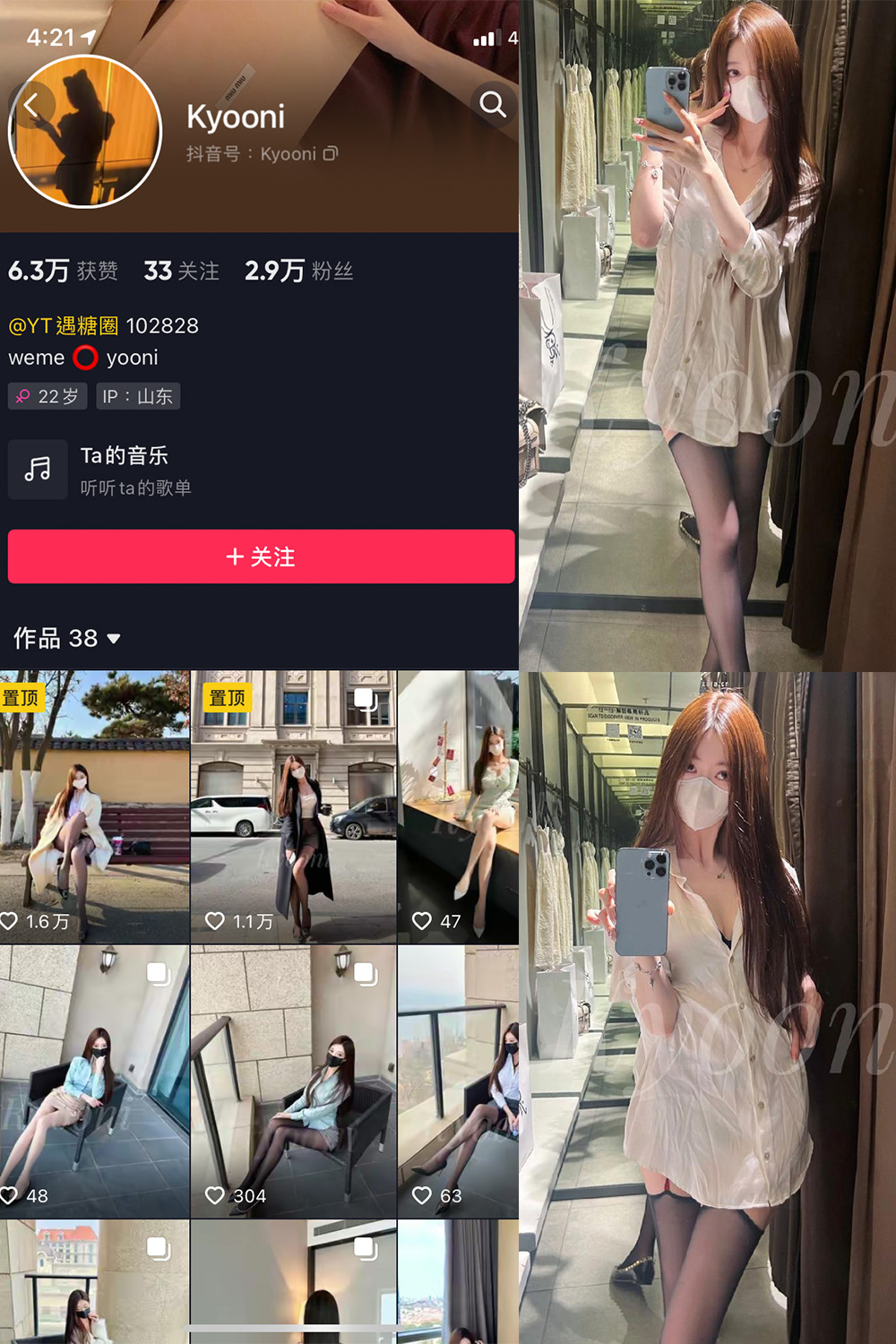 图片[1]-抖音 Yooni有你喵 微密圈  NO.016期 【11P】最新至：2023.7.25-微密空间-全网最全抖音网红铁粉空间觅圈